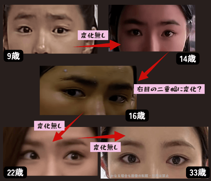 韓国女優シンセギョンの唇の変化について時系列検証画像
以下5枚の画像

9歳（左上画像）
14歳（右上画像）
16歳（中央画像）
22歳（左下画像）
33歳（右下画像）

9歳と14歳の時は左目が二重で右目は奥二重。
16歳の時に右目がはっきり二重になっていることがわかる。